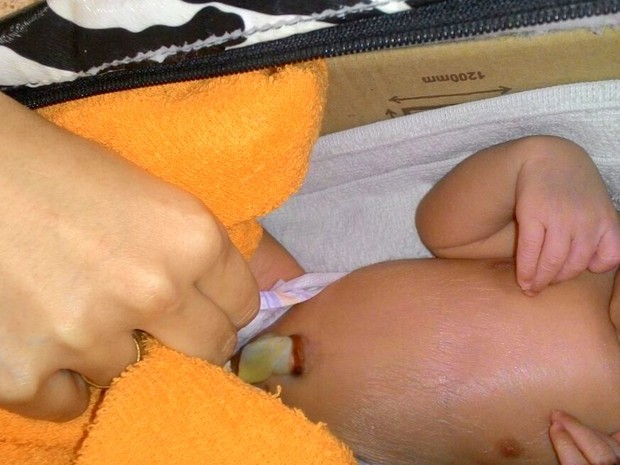 Bebê abandonado em mala em Piracicaba tinha cordão umbilical (Foto: Polícia Militar de Piracicaba)