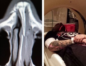 Akira Corassani UFC Instagram (Foto: Reprodução / Instagram)