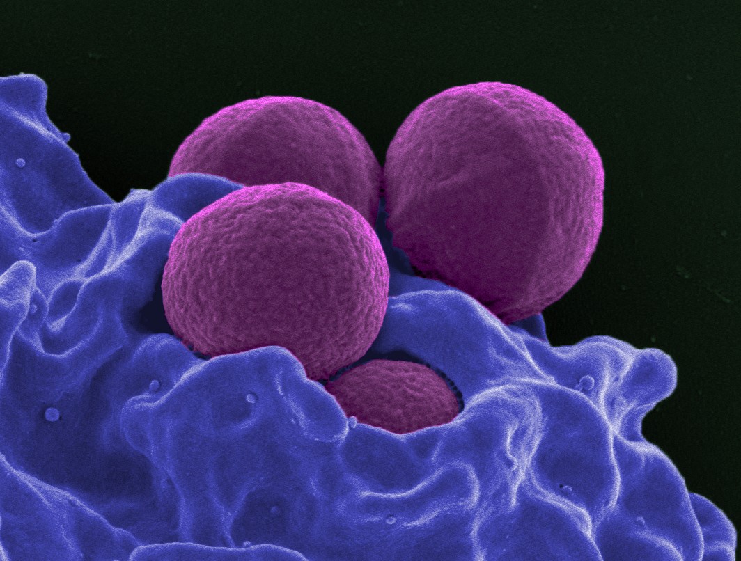 A bactéria Staphylococcus aureus é causadora da fasceíte necrotizante. (Foto: NIH)