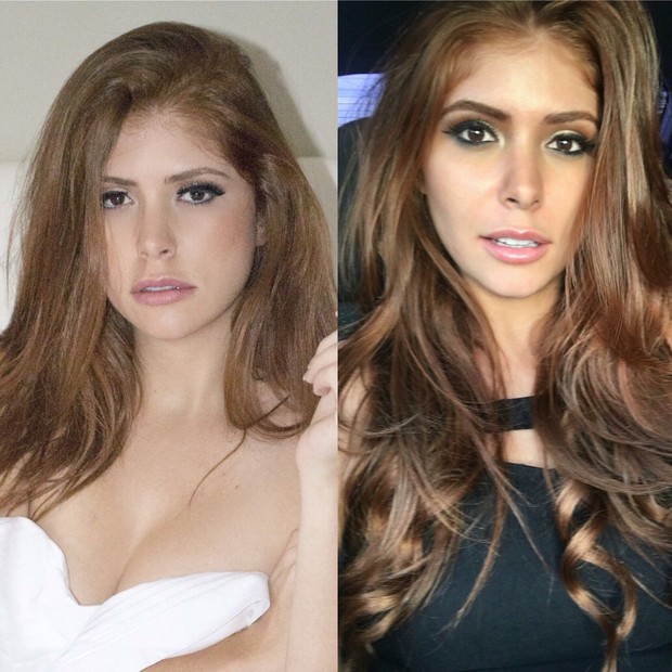 Amanda Gontijo: antes e depois da cirurgia (Foto: Arquivo pessoal)
