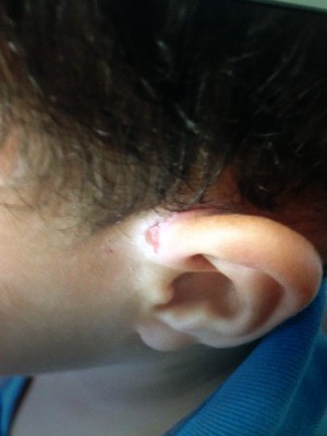 Criança de 4 anos estava cheia de marcas de agressão (Foto: Polícia Civil de Lucas do Rio Verde-MT)