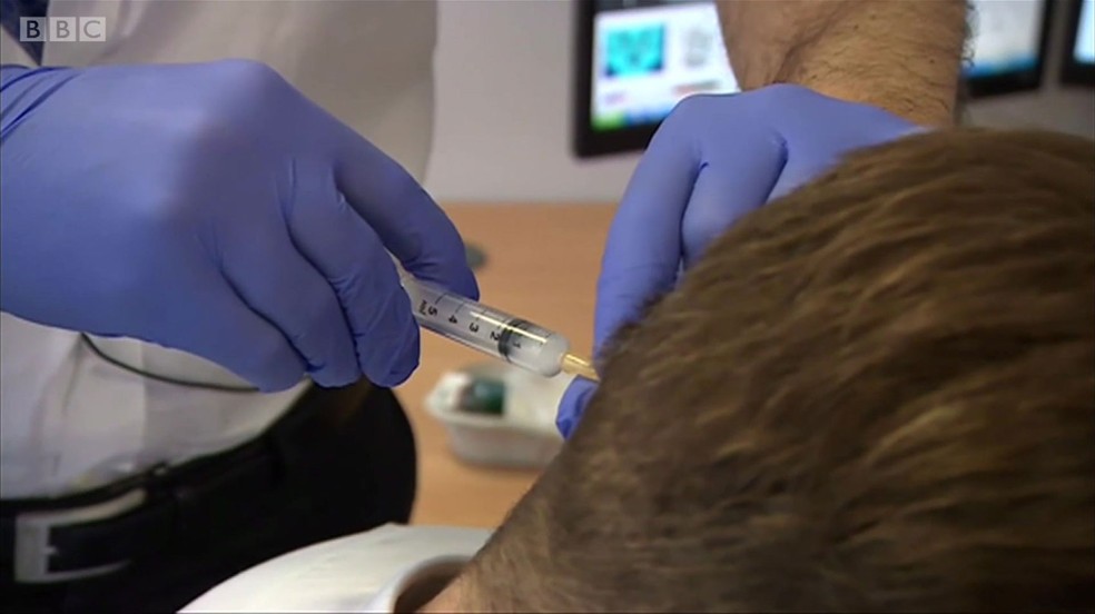 Injeções de esteroides são usadas para aliviar a dor momentaneamente (Foto: BBC)
