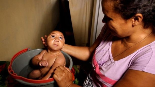 Bebê que ficou conhecido por foto de banho no balde foi internado com pneumonia e se recupera no hospital em Pernambuco (Foto: BBC Brasil)