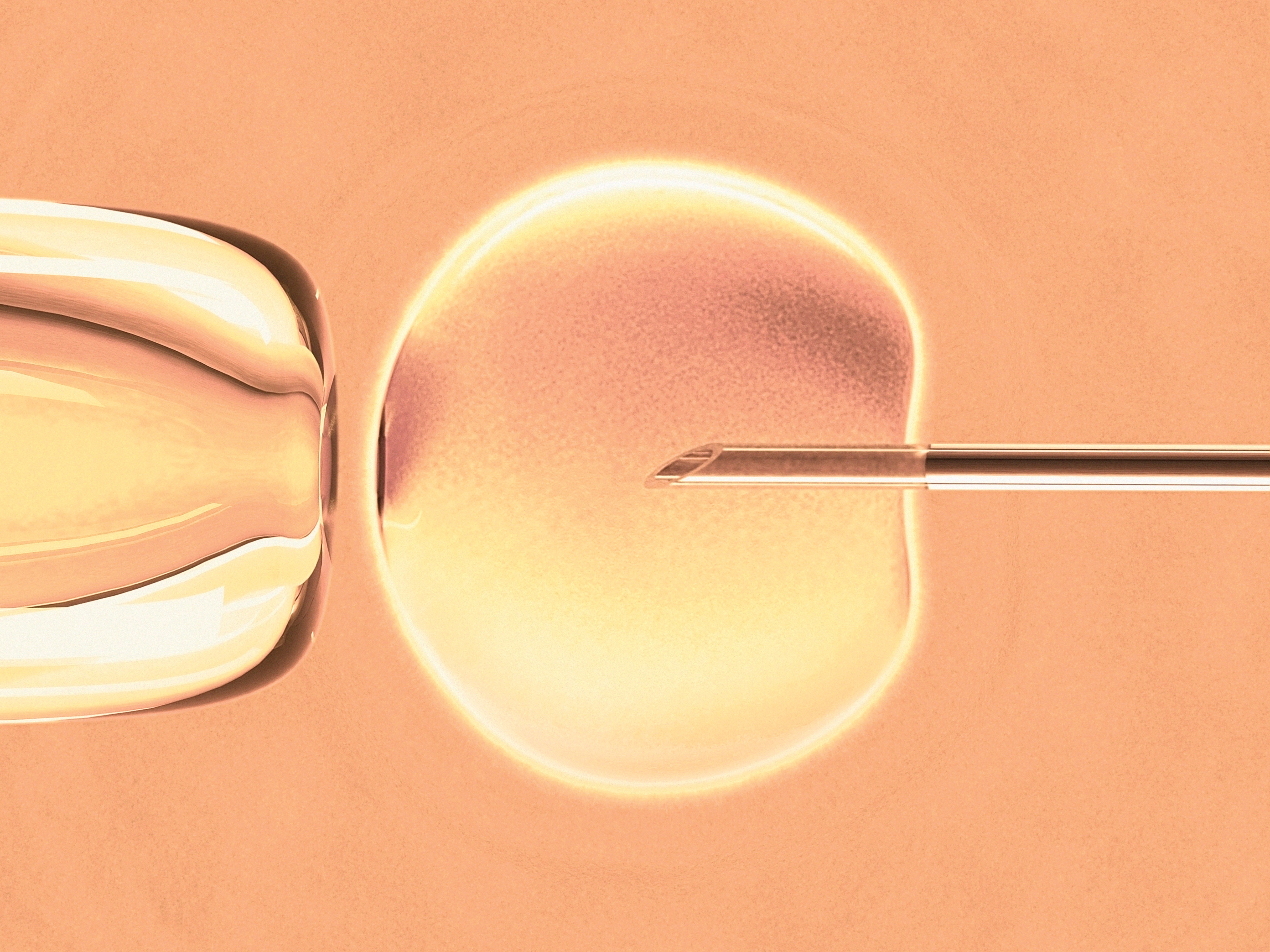 In vitro fertilisation, computer artwork. (Foto: Getty Images/Science Photo Libra)