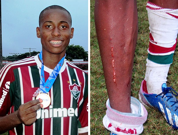 MONTAGEM - Denílson, atacante do Fluminense Sub-20 (Foto: Vicente Seda)