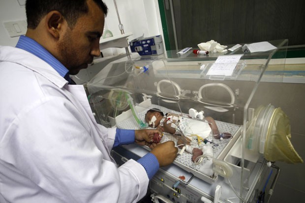 Médico cuida de Shayma Sheikh al-Eid neste domingo (27), dois dias após seu nascimento. Sua mãe morreu às 23 semanas de gravidez, mas bebê sobreviveu (Foto: Said Khatib/AFP)