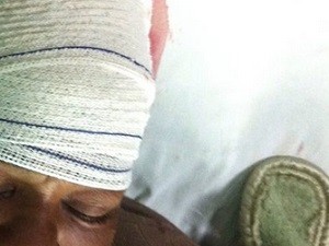 A vítima teve parte do couro cabeludo arrancada pelo companheiro em Teresópolis (Foto: Divulgação/Polícia Civil)