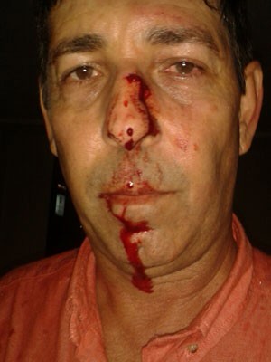 Secretário Clodoaldo Cabral foi agredido nesta quinta (13), em Natal (Foto: Clodoaldo Cabral/Arquivo pessoal)