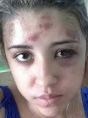 <b>Camile Lopes</b> posta foto em rede social de agressões em Goiás (Foto: <b>Camile</b> ... - a_2