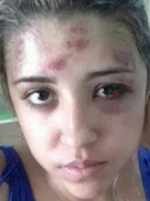 Camile Lopes posta foto em rede social de agresses em Gois (Foto: Camile Lopes/ Arquivo Pessoal)