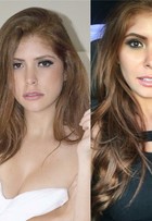 Amanda Gontijo faz cirurgia para diminuir bochechas: 'Bem tranquila'