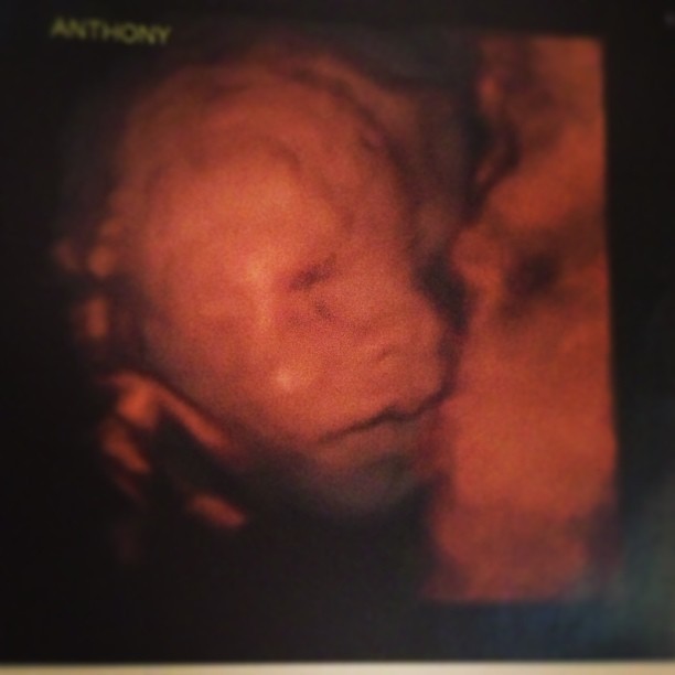 Ultrassonografia de Anthony, filho de Simony com o namorado, Patrick Silva (Foto: Instagram/ Reprodução)