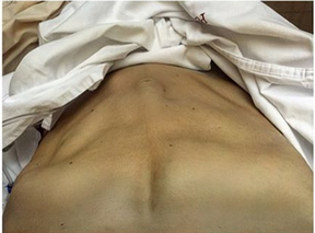 Gabriela Zugliani mostra abdômen após parir (Foto: Reprodução/Instagram)