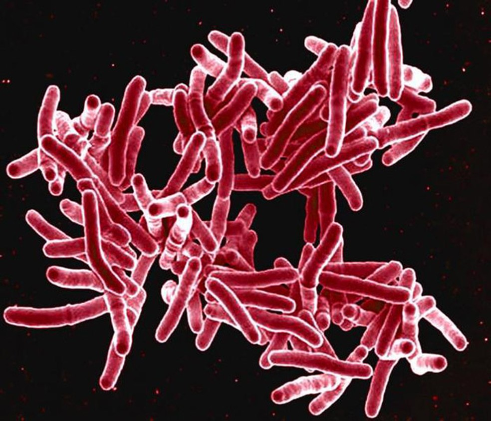   Imagem de microscopia eletrônica  mostra a bactéria 'Mycobacterium tuberculosis', o bacilo de Koch, que provoca a tuberculose  (Foto: National Institute of Allergy and Infectious Diseases (NIAID))