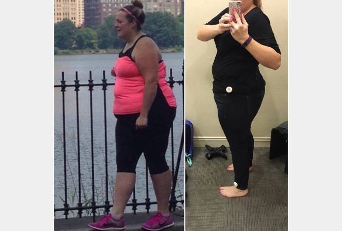 O antes e depois de Alissa, que emagreceu 27 quilos em 4 meses (Foto: Reprodução)
