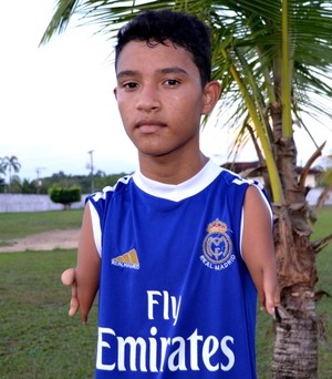 Com má formação congênita, garoto joga bola e supera deficiência no Acre (Foto: Genival Moura)