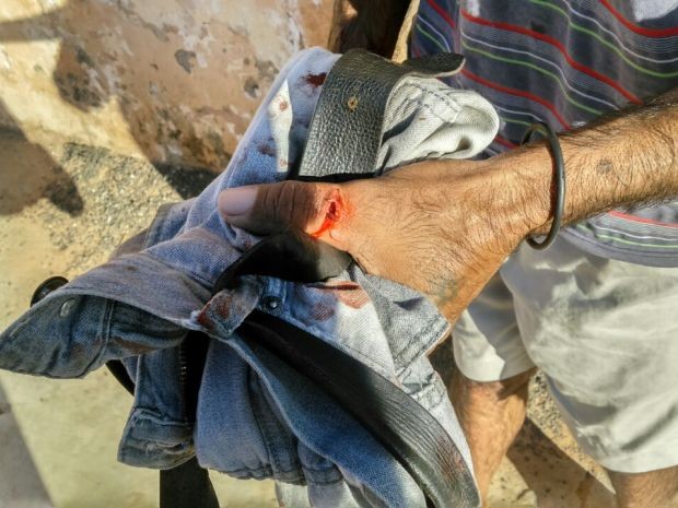 Homem disse que foi mordido por cachorro (Foto: Divulgação / GCM Botucatu)