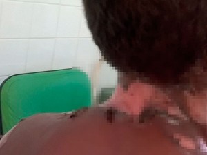 Criança sofreu queimaduras no pescoço, orelha e ombros (Foto: Viviane Moureira / OPOVONEWS)