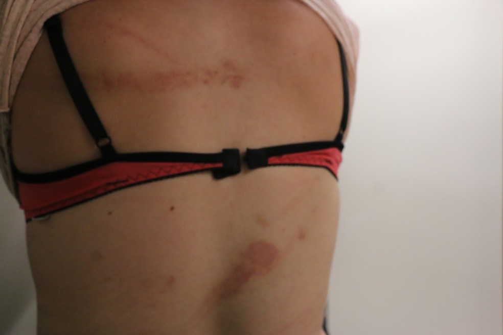 Mulher exibe marcas da violência em visita a juizado especializado (Foto: Joyce Heurich/G1)