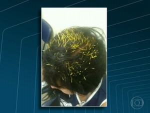 Ouriço-cacheiro cai de poste sobre mulher na Gávea; médicos tiraram mais de 200 espinhos (Foto: Reprodução/Jornal Extra)