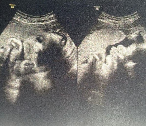 Leticia Santiago mostra ultrassom do filho (Foto: Instagram / Reprodução)