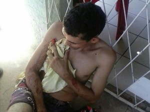 Jovem foi baleado abaixo do peito durante tentativa de homicídio (Foto: PM-PI) Jovem foi baleado abaixo do peito durante tentativa de homicídio (Foto: PM-PI)