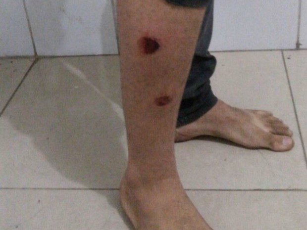 Jovem que se vestiu de palhaço foi atingido por balas de borracha (Foto: Divulgação/Polícia Civil)