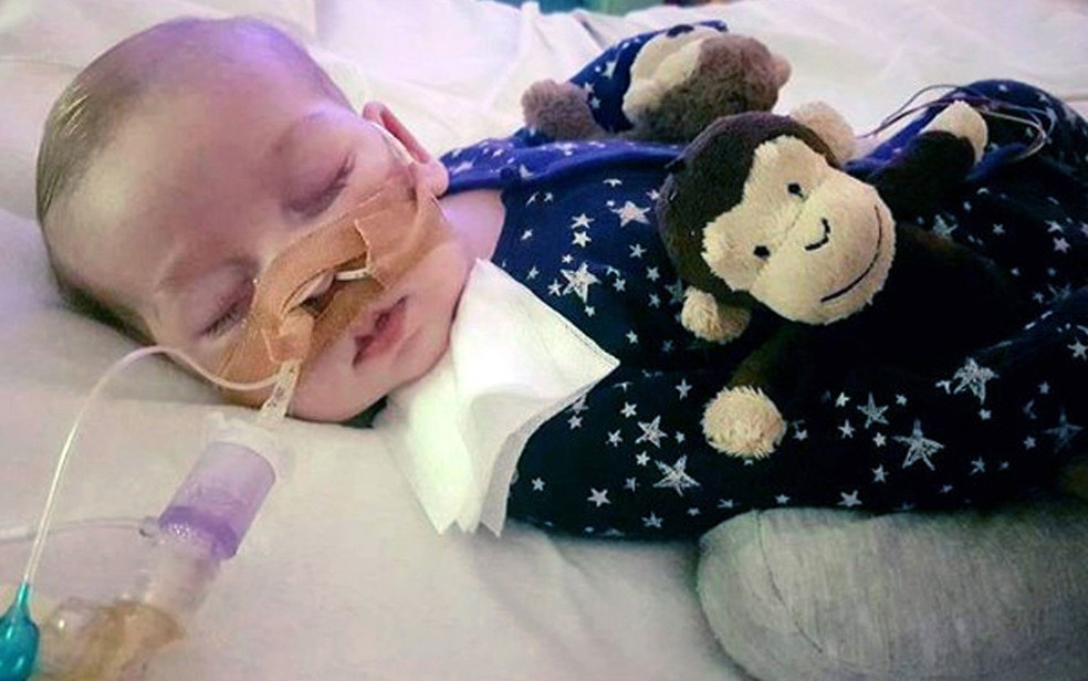 A síndrome rara de Charlie Gard impede que ele se mova (Foto: Family of Charlie Gard via AP)