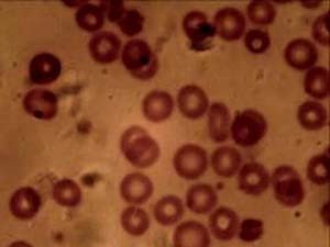 Células do sangue humano