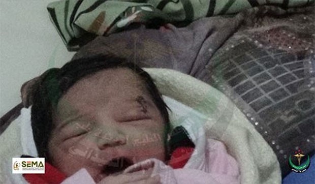 Criança nasceu com ferimento na cabeça após sua mãe ser alvo de bombardeio na Síria (Foto: Reprodução/Facebook/M1hospital)