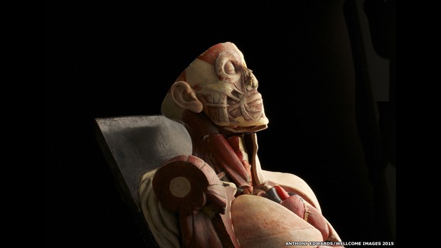   Antigo modelo anatômico estava no fim de sua vida útil quando foi encontrado em Dublin  (Foto: Anthony Edwards/Wellcome Images 2015)