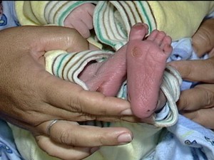 Criança teve os dois pés queimados durante o procedimento (Foto: reprodução/TV Integração)