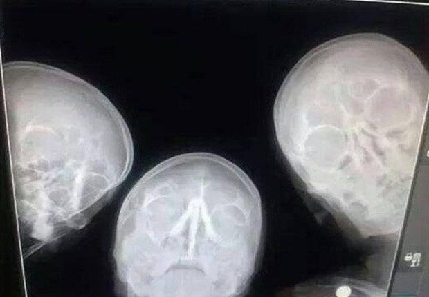 Trio de radiologistas inovou ao tirar selfie em máquina de raio-X (Foto: Reprodução/Imgur/FunStorm1)