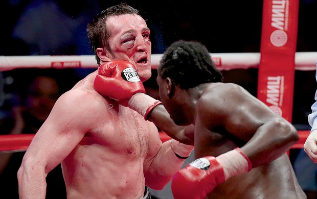Denis Lebedev ferimento rosto boxe (Foto: AP)