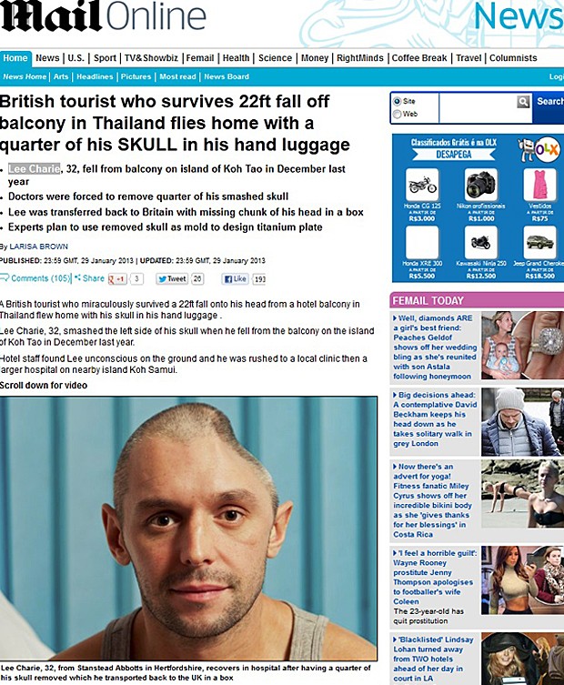 Britânico teve 1/4 do crânio removido após queda na Tailândia (Foto: Daily Mail/Reprodução)