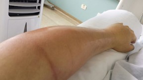 Ken Humano com infecção no braço (Foto: Arquivo pessoal)