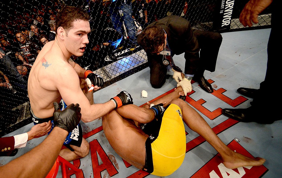 FOTOS: Anderson Silva sofre grave lesão na perna na luta contra Weidman -  fotos em combate