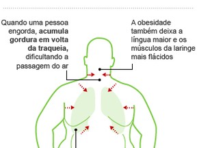 Bem Estar - Apneia Do Sono Leva à Pressão Alta E A Outros Problemas 