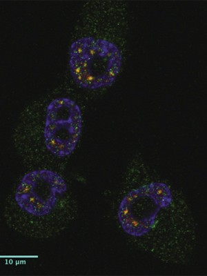 Região em verde na imagem mostra a presença da proteína CPEB1 em quatro células cancerígenas (Foto: Divulgação/IRB Barcelona/'Nature')