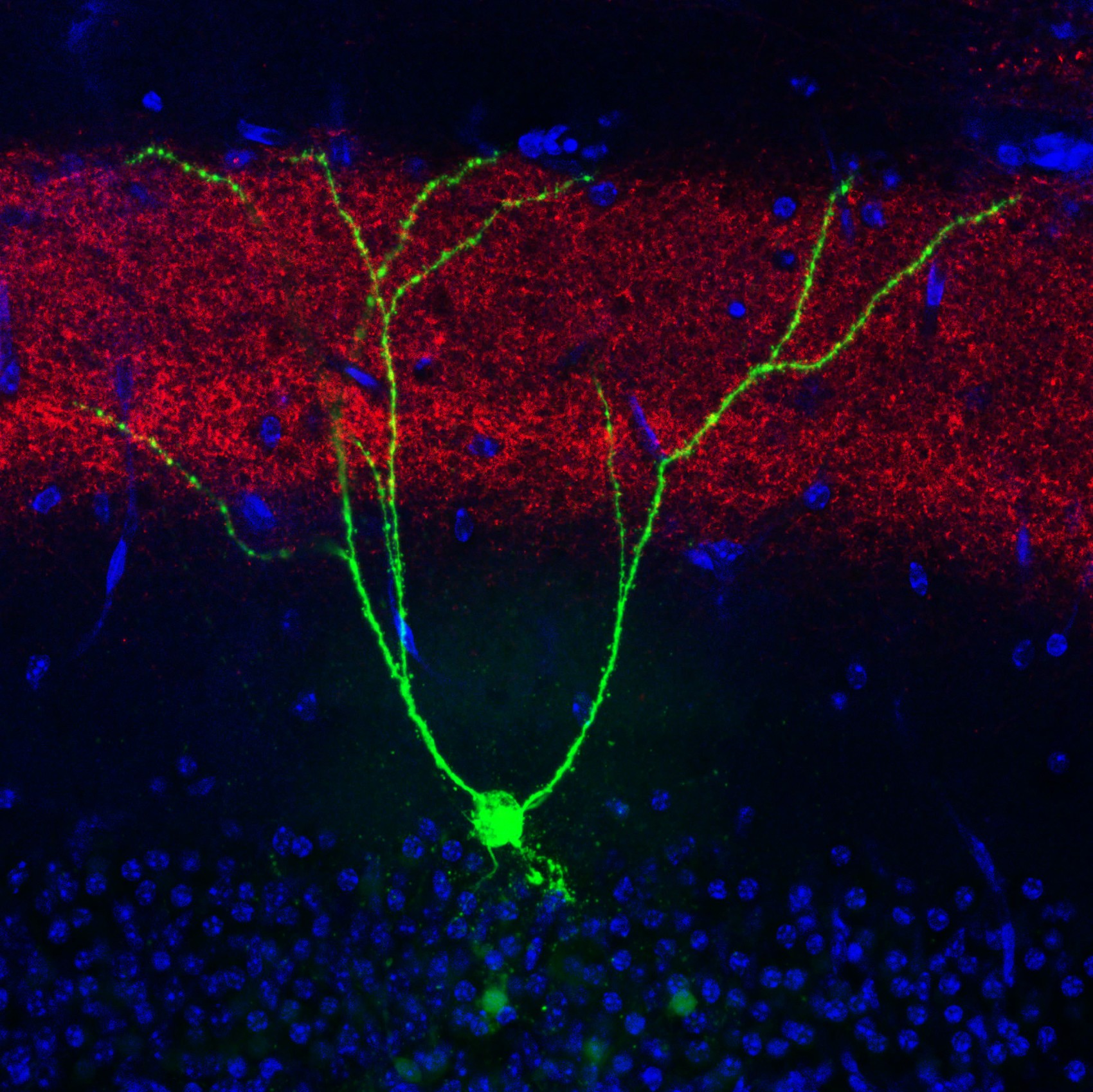  Imagem mostra uma célula de engrama, relacionada à memória, de modelo de camundongo para a doença de Alzheimer: uso de luz foi capaz de fazer animal recobrar memória  (Foto: Riken/Divulgação)