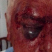 Idoso é agredido em casa por 4 jovens (Polícia Militar/Divulgação)