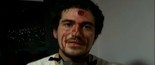 Repórter leva bala de borracha na testa em ato (TV Globo)
