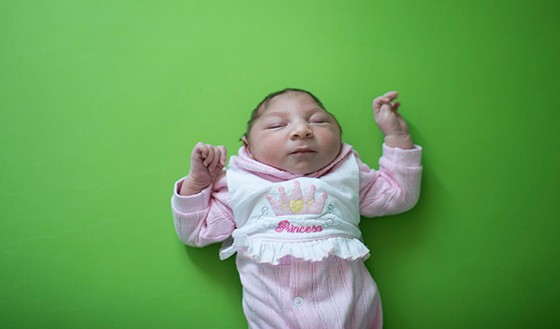 Crainça recém-nascida com microcefalia (Foto: AP Photo/Felipe Dana)