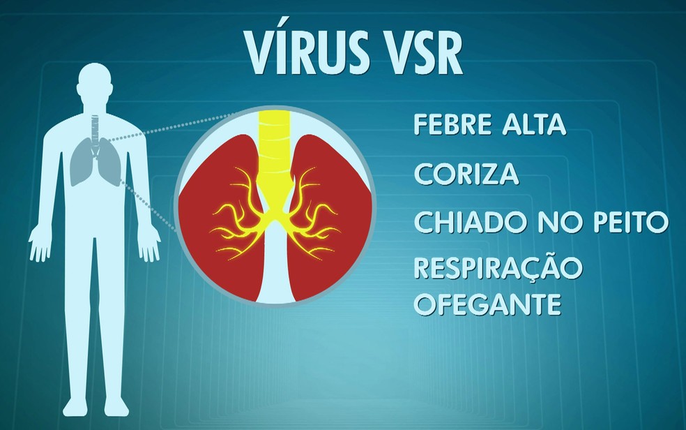 Vírus VSR (Foto: TV Globo/Reprodução)