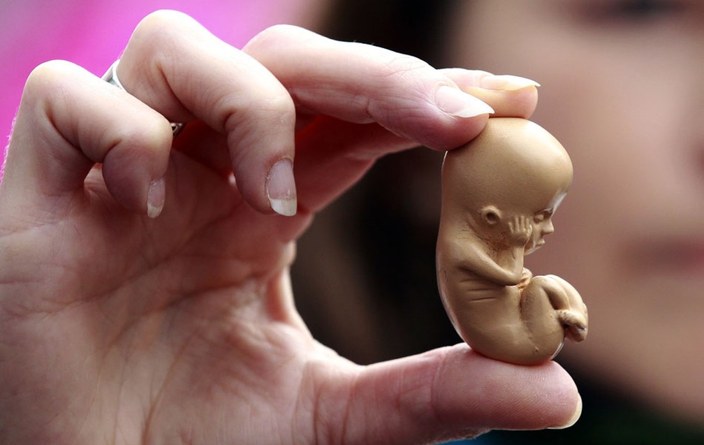 Ativista pró-vida segura modelo de um embrião de 12 semanas de idade, durante um protesto em Belfast, na Irlanda. (Foto: Cathal McNaughton/ Reuters)