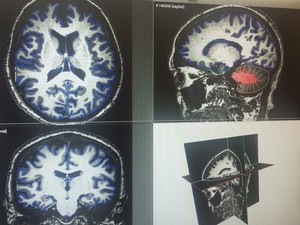 Pesquisador de Mogi compara massa cerebral e cerebelo de idosos sedentários com fisicamente ativos (Foto: Wesley Silvério/ Arquivo Pessoal)