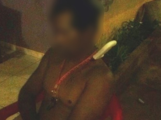 Vítima ficou com faca cravada no pescoço e precisou ser socorrida pelo Samu (Foto: Divulgação/Polícia Militar)