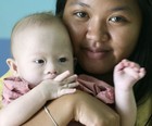 Pai nega abandonar bebê com Down (Apichart Weerawong/AP)
