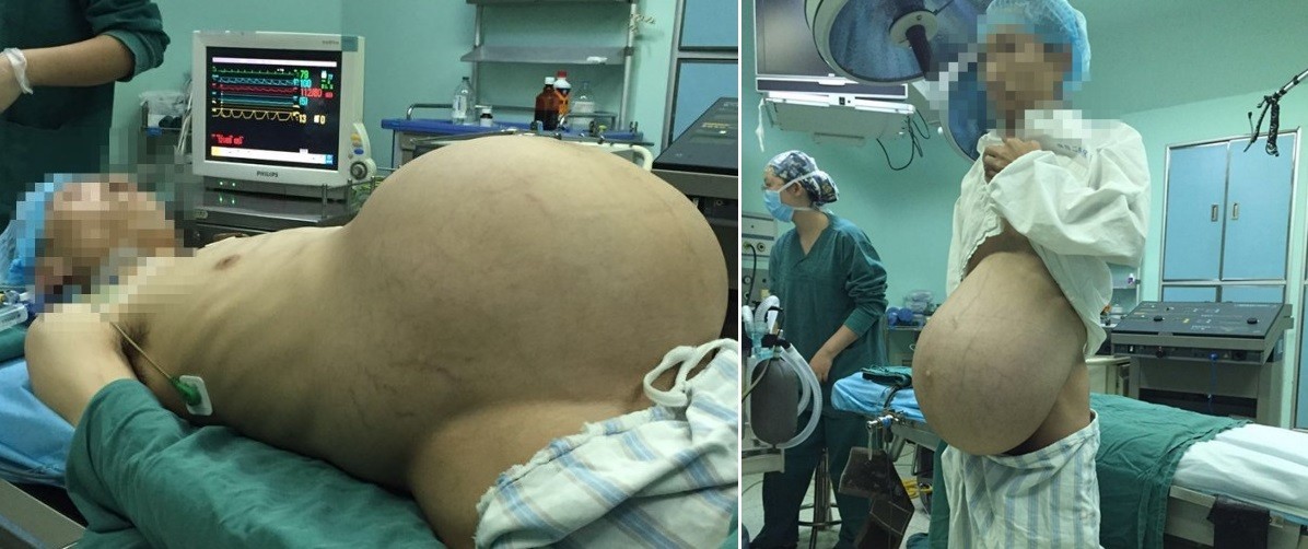 O paciente antes da cirurgia