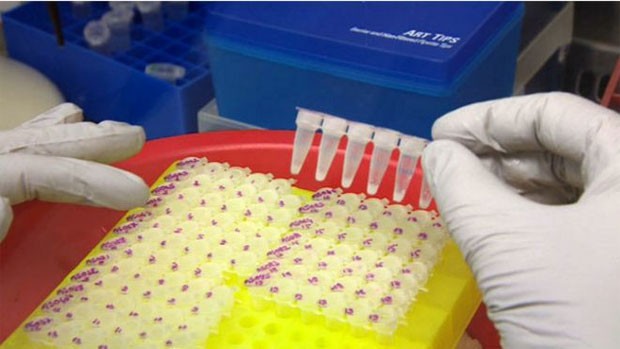  Mais de 600 amostras de sangue de pacientes da Guiné serão analisadas  (Foto: BBC)